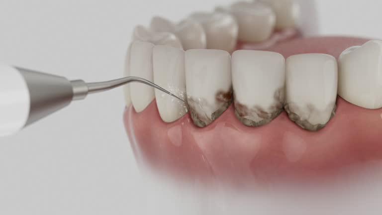 Reliable Tooth Extraction contractor in Van Vleck, TX by Smile Center Dentistry